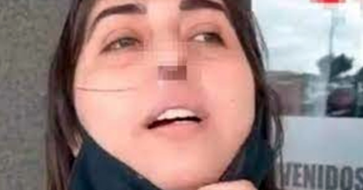 Mujer pierde el cartílago de la nariz luego de realizarse prueba Covid