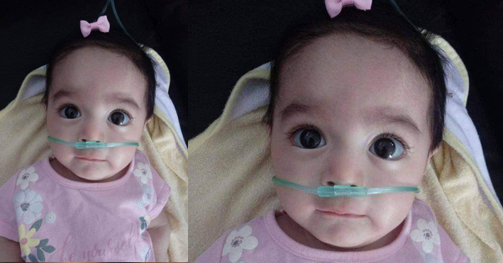 Piden ayuda para la bebé Chole Natalia siga con vida; sufre Atrofía Muscular Espinal