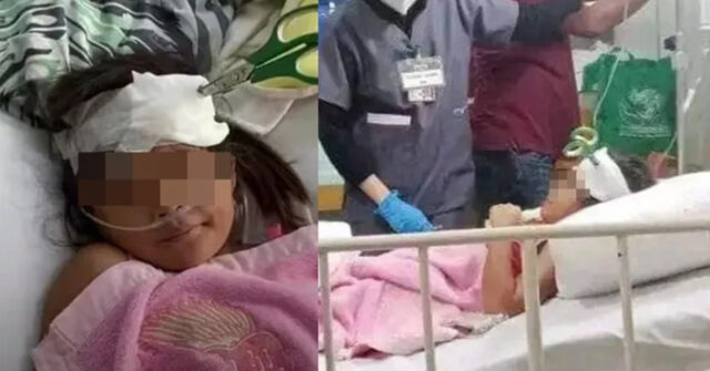 Niña estuvo una semana con unas tijeras clavadas en la cabeza por no tener dinero para la cirugía