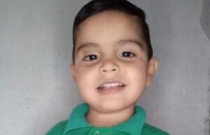 Pitbull ataca a niño de 3 años y le desfigura su rostro en Sonora