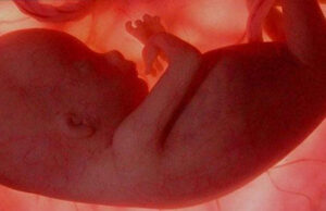 Mujer que quieran abortar tendrán que escuchar primero los latidos del corazón de su bebé Mujer que quieran abortar tendrán que escuchar primero los latidos del corazón de su bebé
