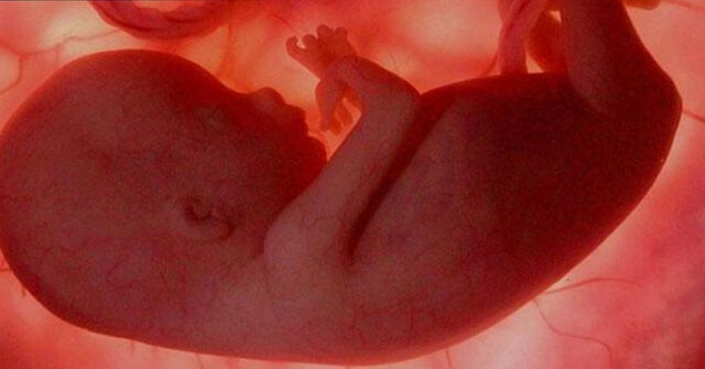 Mujer que quieran abortar tendrán que escuchar primero los latidos del corazón de su bebé