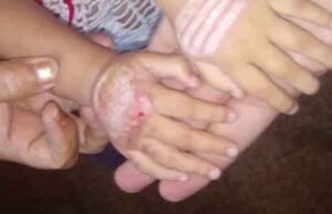 Le quitan niño a mujer que le quemó las manos por portaste mal en Sonora