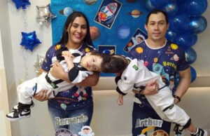 Doctores logra separar a siameses que nacieron con el cráneo unido Doctores logra separar a siameses que nacieron con el cráneo unido