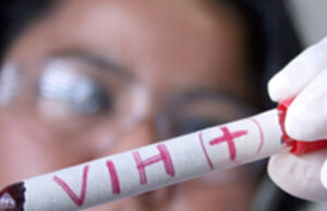 Confirman paciente curado de VIH luego de recibir trasplante de células Confirman paciente curado de VIH luego de recibir trasplante de células